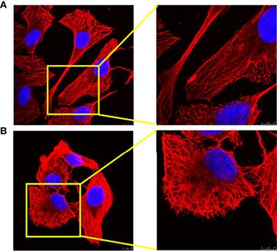 Effect of Platycodon grandiflorus Polysaccharide on M1 Polarization Induced by Autophagy Degradation of SOCS1/2 Proteins in 3D4/21 Cells